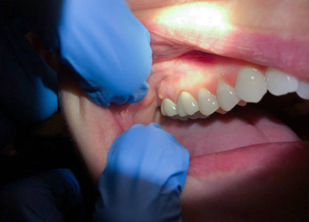 Best Weekend Emergency Dentist in Churubusco, IN