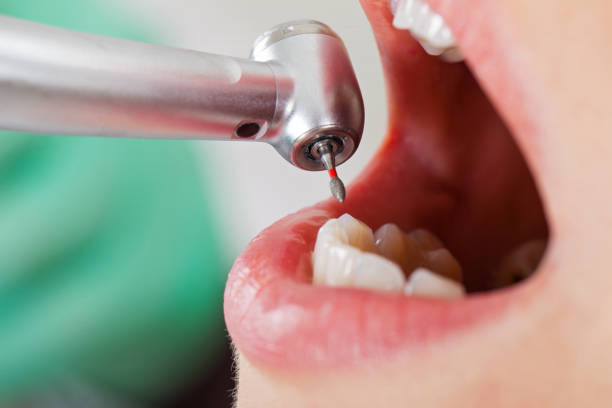 Best Emergency Dental Services for Seniors in Churubusco, IN